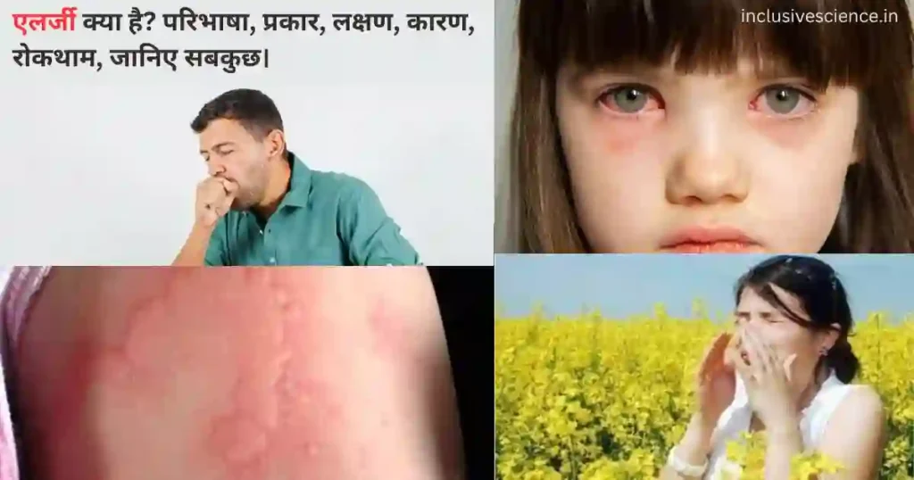 allergy kya hai, एलर्जी क्या है